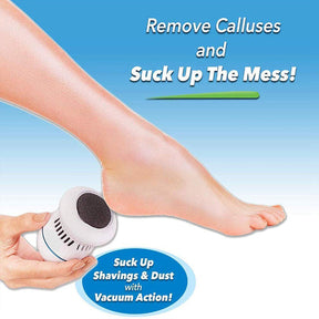 ELECTRIC CALLUS REMOVER FOR FEETS